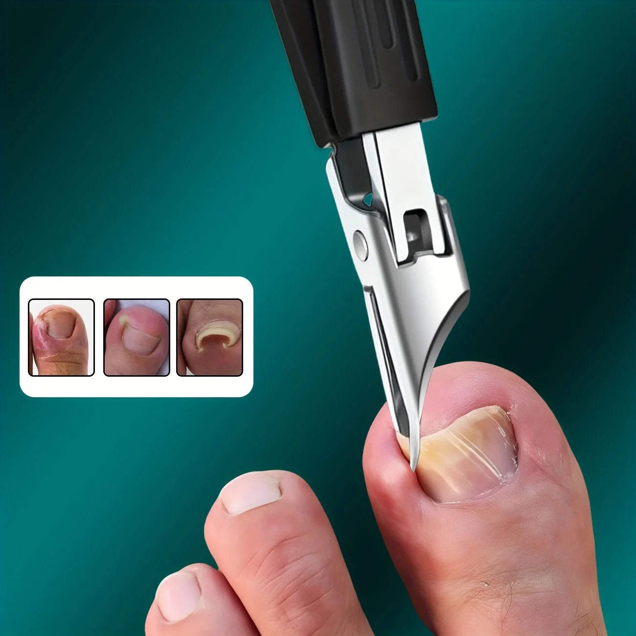 Thick Ingrown Nails Heavy Duty